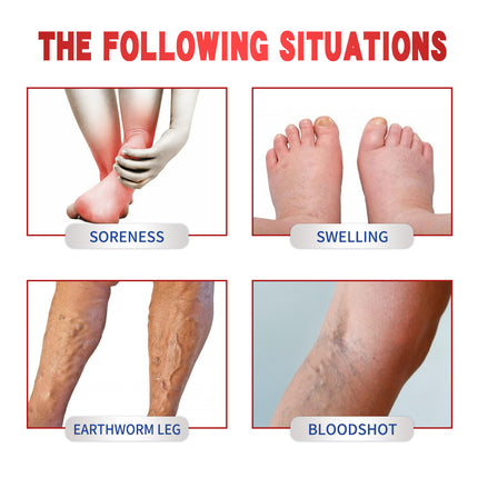 Varicose Veins Patch, Relief Of Swelling Pain Earthworm Leg Massage Activating Repair Patch
