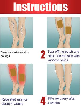 Varicose Veins Patch, Relief Of Swelling Pain Earthworm Leg Massage Activating Repair Patch