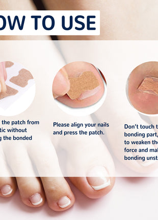 Nail Correction Patch, Nail Insert Correction And Repair Toe Manicure Nail Patch