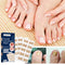 Nail damage