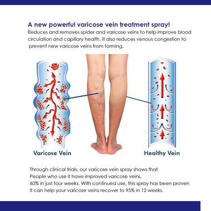 Intravenous Spray, Relief Of Varicose Blood Vessel Bulge Pain Intravenous Massage Treatment Spray