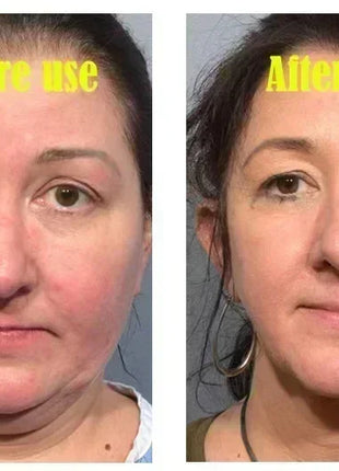 V-Shape Face Slimming Lifting Facial Cream Effective Lift Up V Double Chin Cheek Slimming Firming Anti Wrinkle Beauty Skin Care