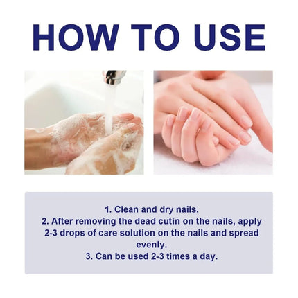 10ml Nail Fungus Repair Nail Care Liquid Hands Soft Nails Nail Care Moisturizer Feet Brightens Nails Nail Drops