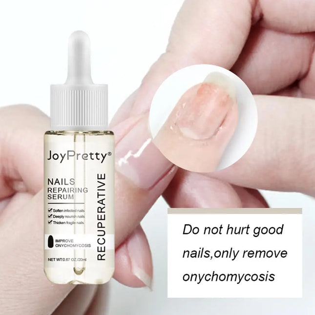 20ml Repairing Serum Nails Repairing Serum Nail Day Serums Toenail 7 Nourishing Nails From Discoloration Protects V4r0