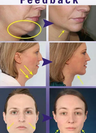 V-Shape Face Slimming Lifting Facial Cream Effective Lift Up V Double Chin Cheek Slimming Firming Anti Wrinkle Beauty Skin Care