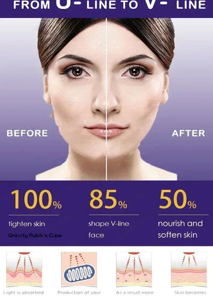 V-Shape Face Slimming Lifting Facial Cream Effective Lift Up V Double Chin Cheek Slimming Firming Anti Wrinkle Beauty Skin Care