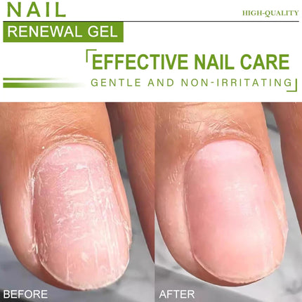 Vitamin E Nail Renewal Gel For Thin Nails Growth And Strengthening Serum Nourishing Repair Damaged Nail Healthy Nail Care 20g
