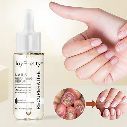 20ml Repairing Serum Nails Repairing Serum Nail Day Serums Toenail 7 Nourishing Nails From Discoloration Protects V4r0