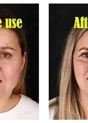 V-Shape Face Slimming Lifting Facial Cream Effective Lift Up V Double Chin Cheek Slimming Firming Anti Wrinkle Beauty Skin Care