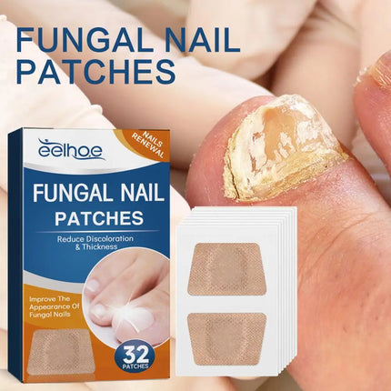 32Pcs/Box Universal Nail Ditch Repair Patch Compact Nail Repair Stickers Ingrown Toenail Correction Sticker Foot Care