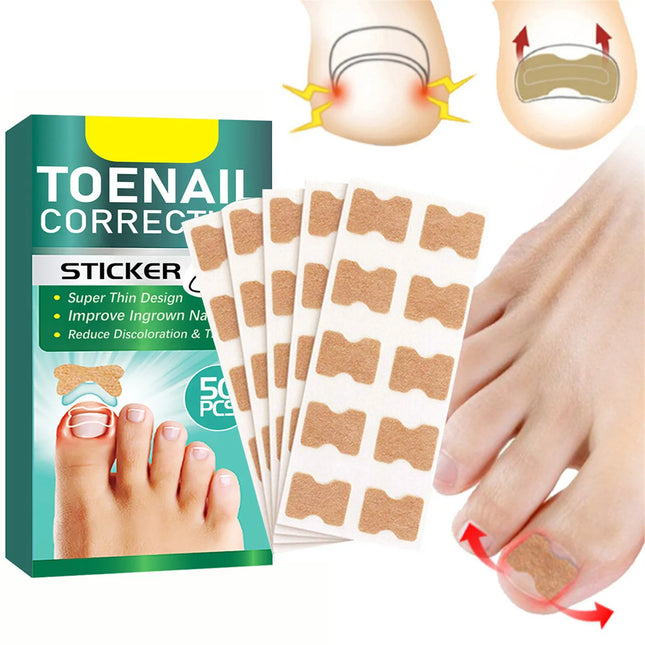 Ingrown Toenail Correction Stickers Hands And Feet Soft Nail Inlaid Nail Thickening Bright Nail Furrow Gray Nail Care Patch 50pc