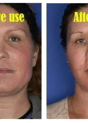 V-Shape Face Slimming Lifting Facial Cream Effective Lift Up V Double Chin Cheek Slimming Firming Anti Wrinkle Beauty Skin Care