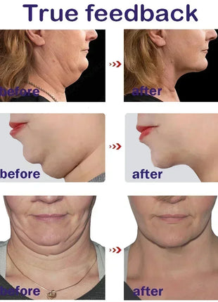 V-Shape Face Slimming Lifting Facial Cream Effective Lift Up V Double Chin Cheek Slimming Firming Anti Wrinkle Beauty Skin Care