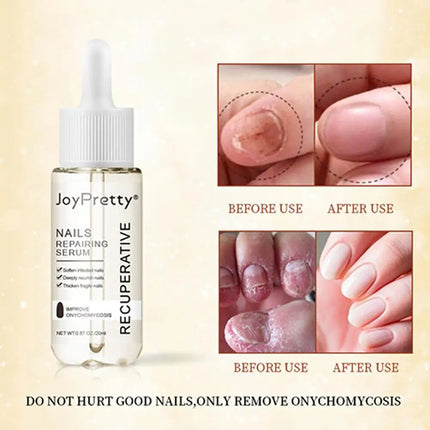 20ml Repairing Serum Nails Repairing Serum Nail Day Serums Toenail 7 Nourishing Nails From Discoloration Protects V4r0