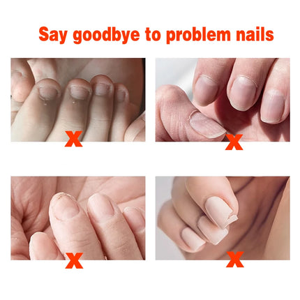 KODIES GEL Nail Cuticle Oil Plant Unrefined Protector Nail Repair Revitalizer Oil 20ML Prevent Agnail Nail Strengthener Hardener