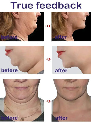 V-Shape Face Slimming Lifting Facial Cream Effective Lift Up V Double Chin Cheek Slimming Firming Anti Wrinkle Beauty Skin Care