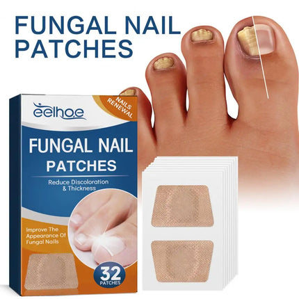 32Pcs/Box Universal Nail Ditch Repair Patch Compact Nail Repair Stickers Ingrown Toenail Correction Sticker Foot Care